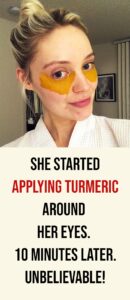 She Started Applying Turmeric Around Her Eyes. 10 Minutes Later. UNBELIEVABLE!