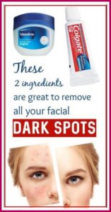 Use Colgate and Vaseline to Get Rid Of Dark Spots On The Face