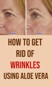 This Homemade Gel Can Remove Wrinkles, Stretch Marks, Blemishes And Burns