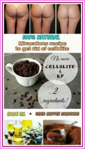 100% Natural Miraculous Recipe to Get Rid of Cellulite