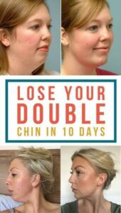 5 Exercises That Will Eliminate Your Double Chin