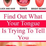 WHAT YOUR TONGUE IS TRYING TO TELL YOU ABOUT YOUR HEALTH