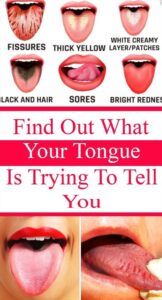 WHAT YOUR TONGUE IS TRYING TO TELL YOU ABOUT YOUR HEALTH