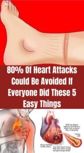 80% Of Heart Attacks Could Be Avoided If Everyone Did These 5 Easy Things